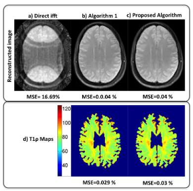 MATLAB codes for Blind compressed sensing (BCS) dynamic MRI